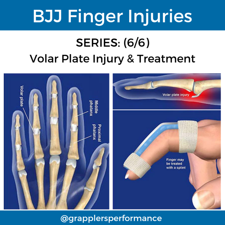 BJJ Finger Injury: Volar Plate Injury Finger Grapplers Performance